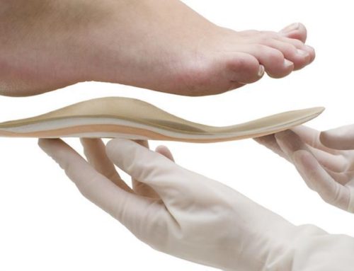 Everything You Need to Know About Prescription Custom Orthotics